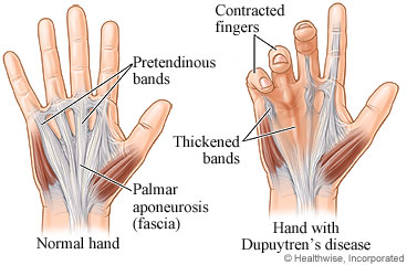 hand muscle bone image